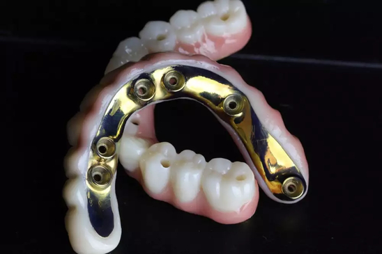 Slider image (4) All On X Dental Studio: Leading Dental Clinic in Los Algodones